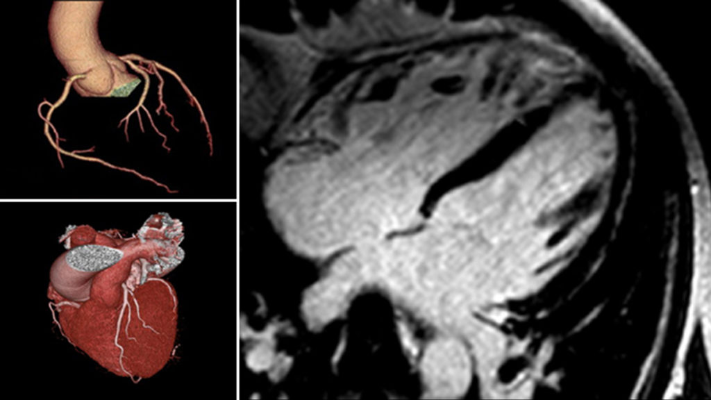 Advanced image analysis ATRIA CLINIC